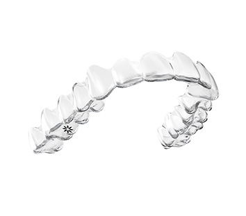 Zahnschiene Invisalign AllDent